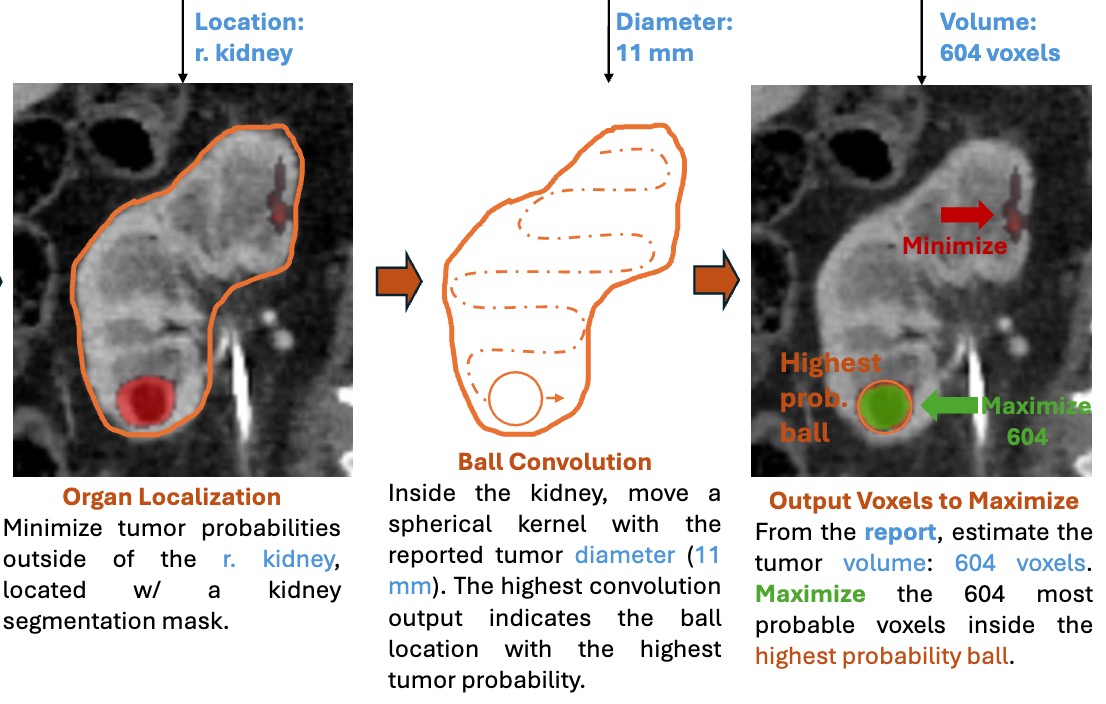 Learning Segmentation from Radiology Reports