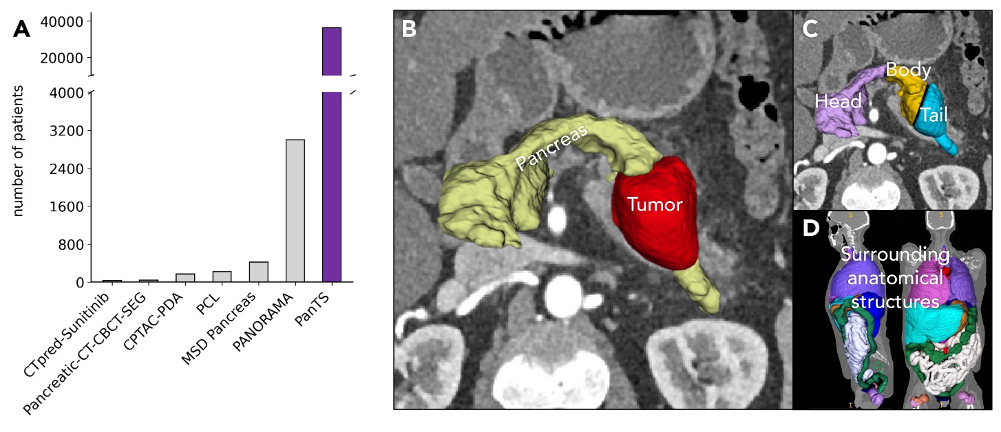 PanTS: The Pancreatic Tumor Segmentation Dataset