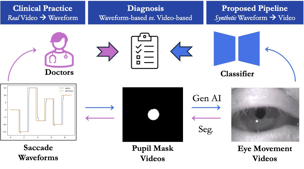 EyePose: Pose-guided Saccadic Eye Movement Video Generation for Deep Learning-Based Neurologic Disease Phenotyping