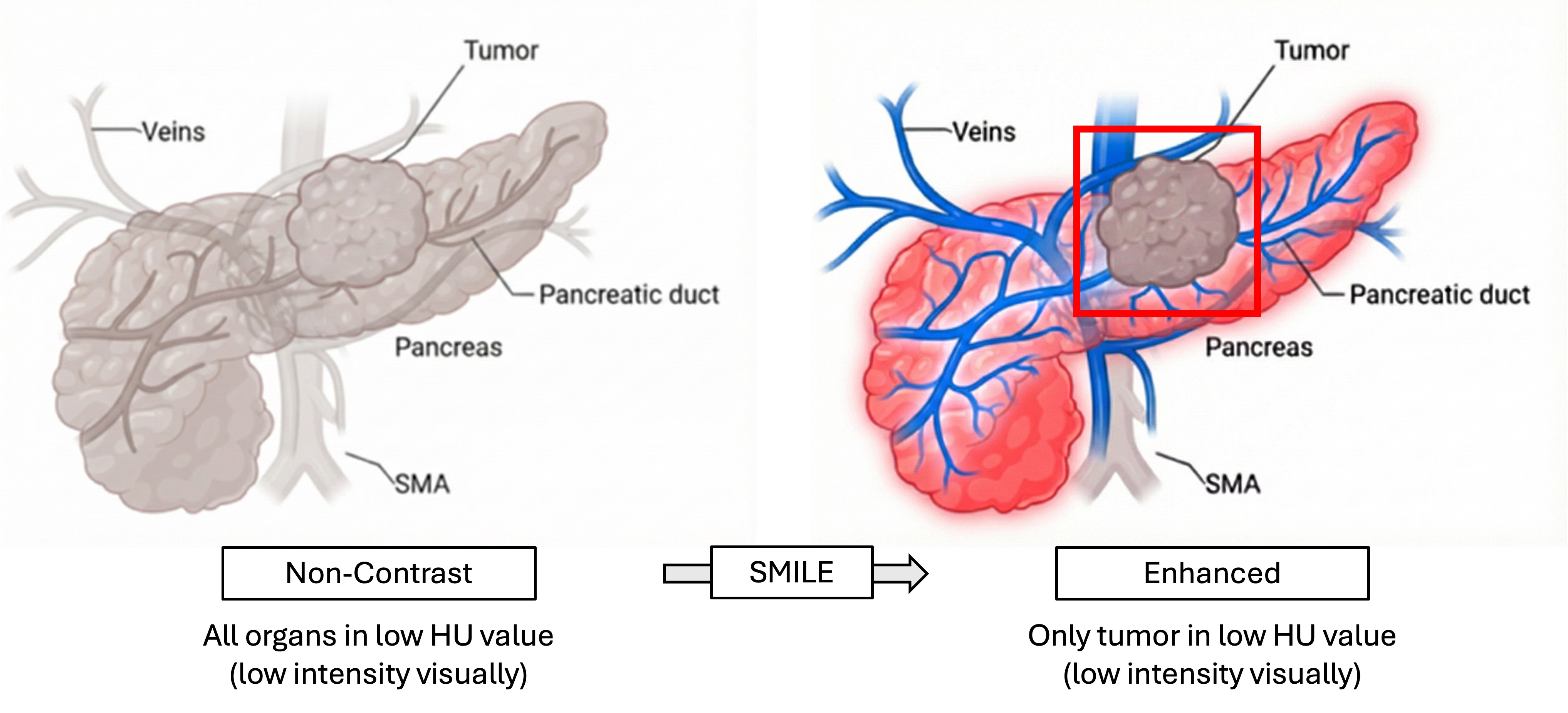 See More, Change Less: Anatomy-Aware Diffusion for Contrast Enhancement