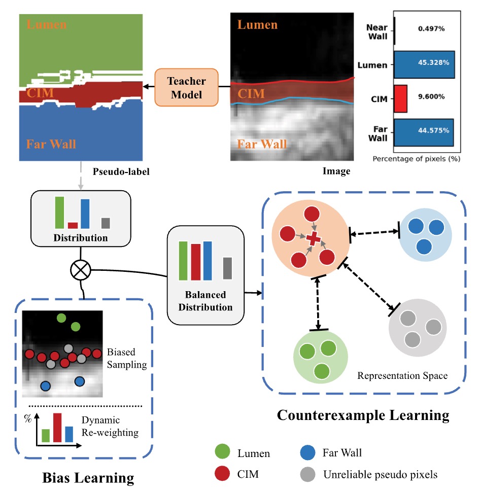 A priority-guided contrastive network for delineating vascular layers in arterial ultrasound